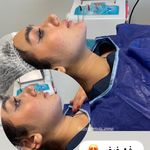 مرکز لیزر ،پوست و زیبایی کندی بیوتی