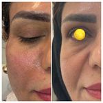 کلینیک زیبایی و لیزر باران در شهرری
