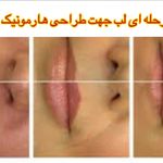 دکتر زیبایی حاجی زاده