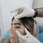 کلینیک زیبایی و لیزر مو  گندم