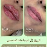 کلینیک لیزر و زیبایی سنسو