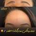 مرکز لیزر و کلینیک زیبایی پریفا