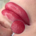 میکروکیماسی( میکروابرو چشم لب،ریمو)