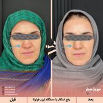 مرکز پزشکی و زیبایی میروژ سنتر