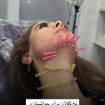 کلینیک لیزر و زیبایی دایان