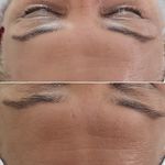 فیشیال و پاکسازی پوست عاطفه سهیلی