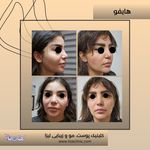 مطب پوست مو زیبایی فردوس شرق