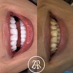 کلینیک دندانپزشکی دکتر زهرا رئیسی زاده
