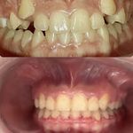 متخصص ارتودنسی دکتر ابریشم چی کرج