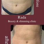 مرکز زیبایی رادا