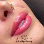 کلینیک زیبایی دکتر هدیه دهقانپور