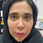 کلینیک ژل بوتاکس لیزر فیل بیوتی