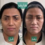کلینیک زیبایی فرتاک