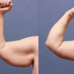 کلینیک زیبایی الماس کاملا اقساطی