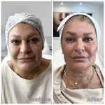 مطب زیبایی دکترمونازرنگ