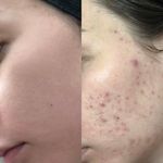 Derma Elan