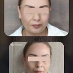 کلینیک پوست،مو، زیبایی و لیزر بارانا