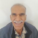 دندانسازی الماس