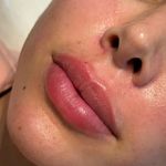 کلینیک پوست مو لیزر رومنس