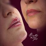 پوست مو فیلر جوانساز دکتر شاه نعمت الهی