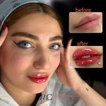 مرکز میکروبلیدینگ فیبروز ابرو
