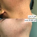 مرکز لیزر وکلینیک زیبایی پایون(بانوان)