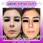 دکترمیراحدموسوی