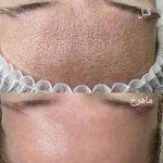 خدمات فیشال پاکسازی/اسکالپ اسکراپ ماهرخ