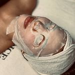 فیشال درمانی و جوانسازی سحرجدیدی