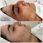 آموزش و خدمات فیشال و پاکسازی پوست aliva