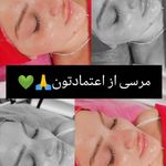 سالن پاکسازی پوست وفیشیال صورت زیبارو