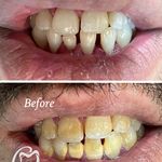 مطب دندانپزشکی دکتر فاطمه قانعی گلبهار