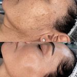 پاکسازی پوست و مو مهسام