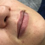 میکروبلیدینگ پریسا پارسا