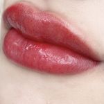بله | کانال میکروبلیدینگ،شیدینگ لب تخصصی یزد