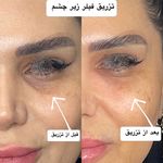 کلینیک لیزر و زیبایی پرین