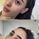 اصلاح ابرو،وکس صورت،لیفت ابرو