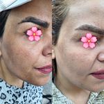 فیشال تخصصی معصومه قاسمی