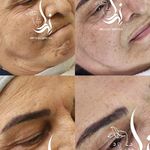 فیشال درمانی و پاکسازی پوست میرجلیلی