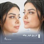 مجموعه زیبایی آتیماه