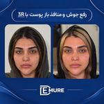 مرکز تخصصی زیبایی و جوانسازی دمور