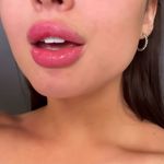 کلینیک پوست مو لیزر رومنس