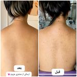 فیشیال / خدمات پوست / سالن زیبایی