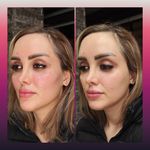 مطب پوست ،مو و لیزر یسنا طب