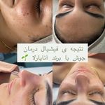 مرکز پوست و مو و زیبایی(ریلکسی) گلارین