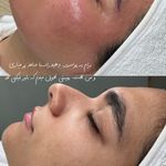 کلینیک فیشال و ماساژ سارن اسکین سارا