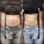 کلینیک لاغری آسایش کرایولیپولیز