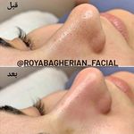 آموزش و خدمات پوست و فیشال رویا باقریان