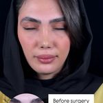 کلینیک جراحی بینی مینی bini mini