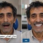 دندانسازی لبخند